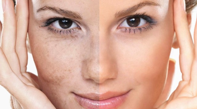 Улучшение цвета лица