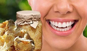 Забрус для зубов