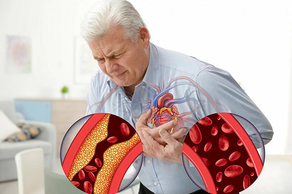 При ишемической болезни