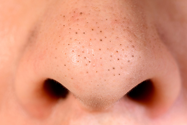 От черных точек