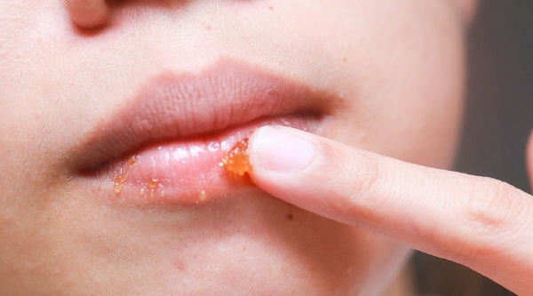 Нанесение скраба