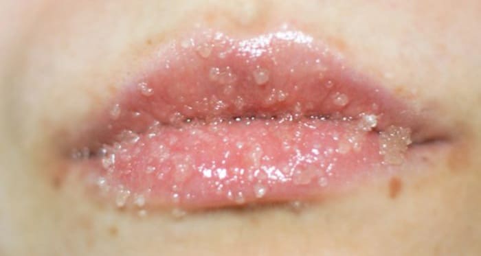 Скраб с сахаром