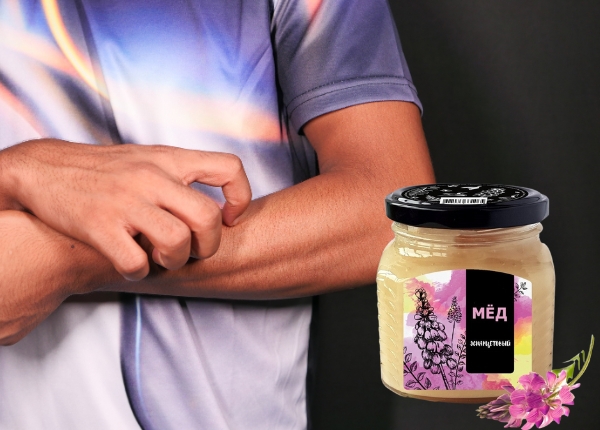 Аллергия на мед
